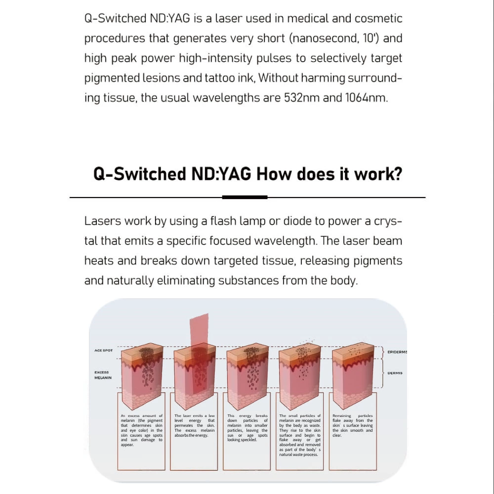 Q-Switched Nd: جهاز التجميل بالليزر YAG